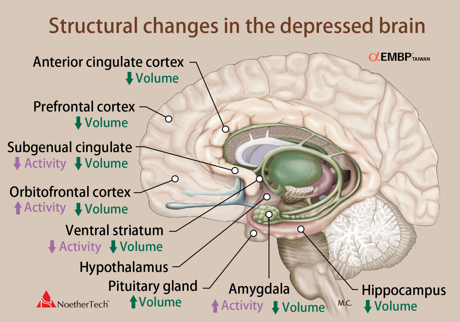 Structural and functional brain abnormalities in MDD