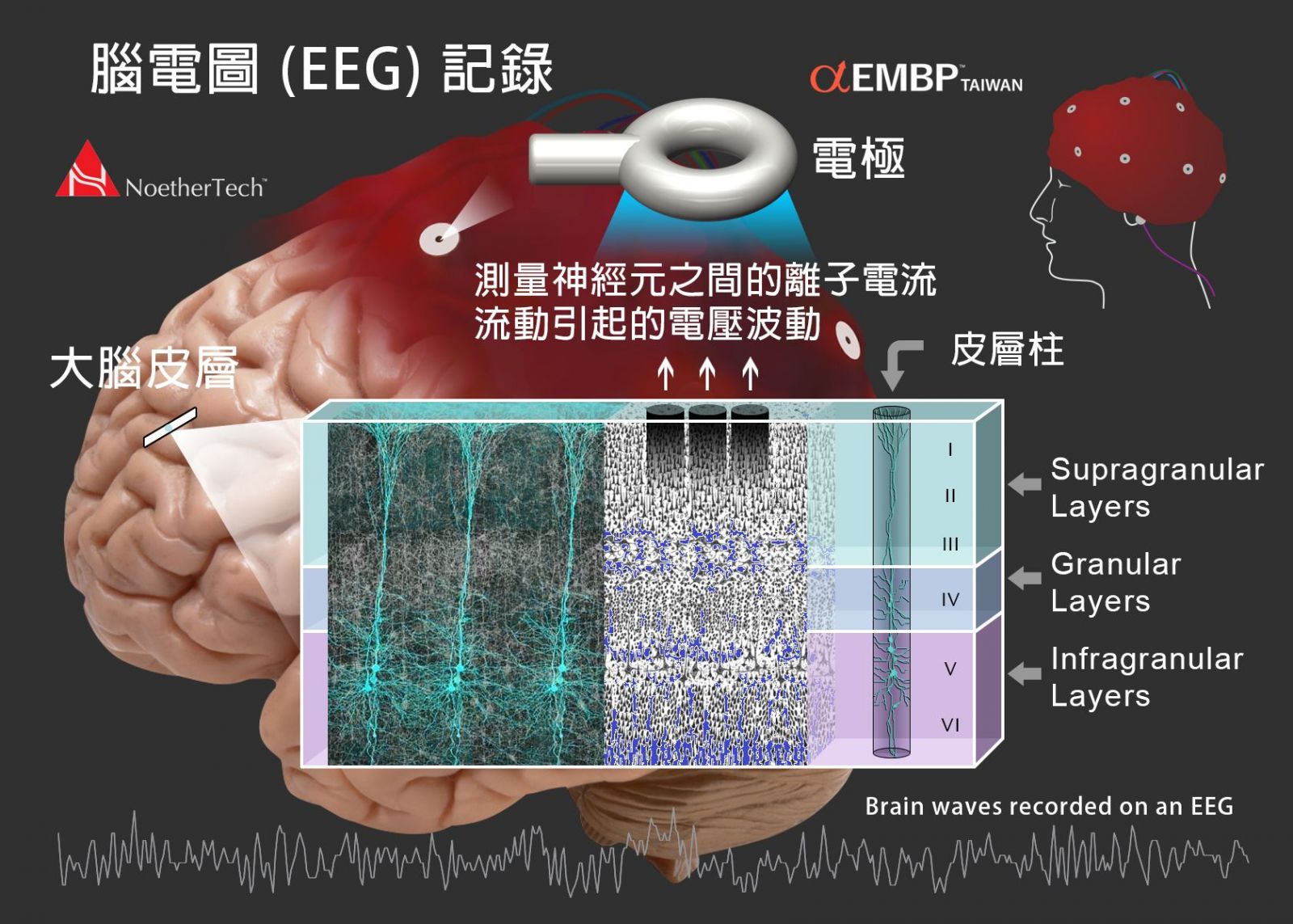 腦電圖 EEG 測量