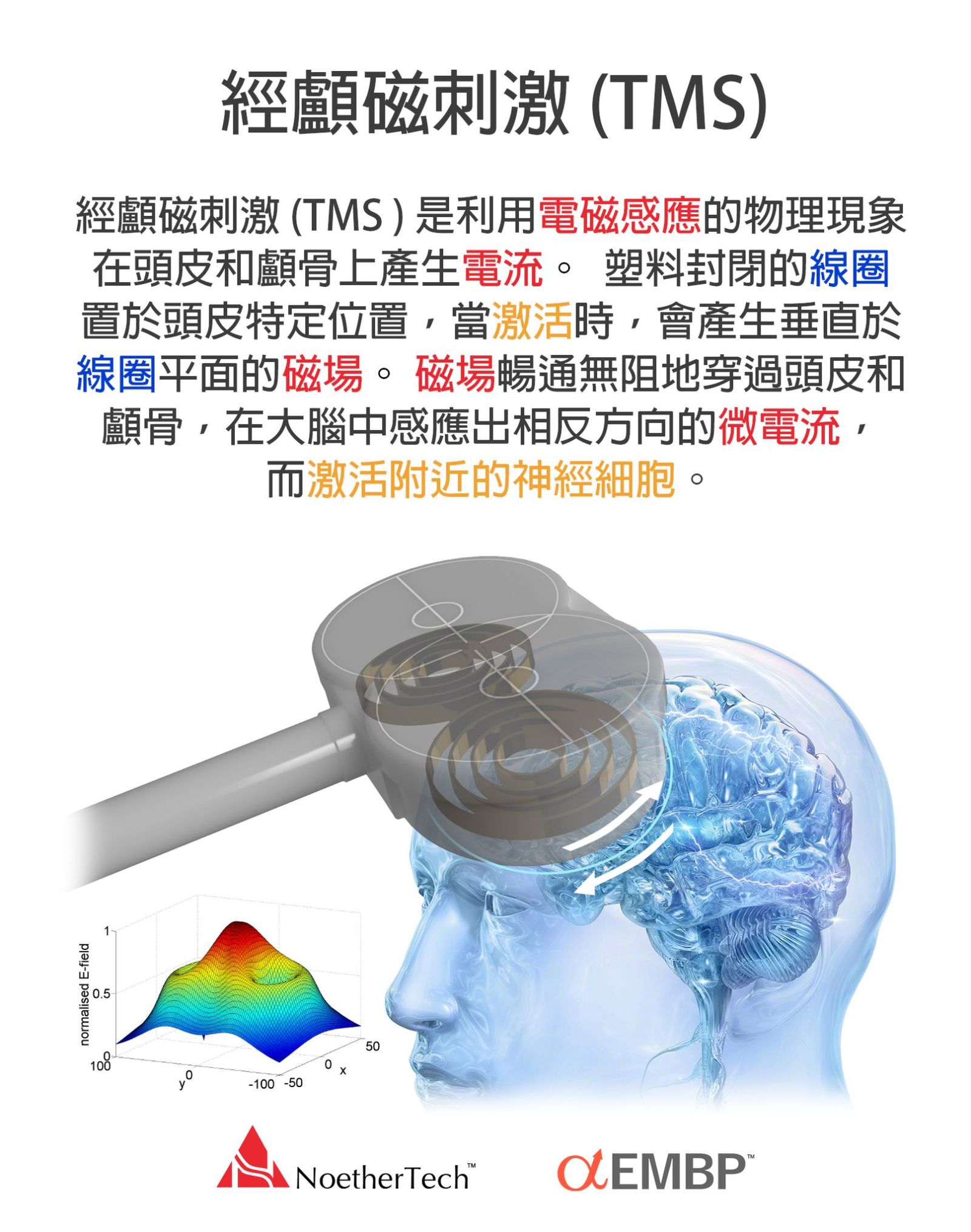 經顱磁刺激 TMS